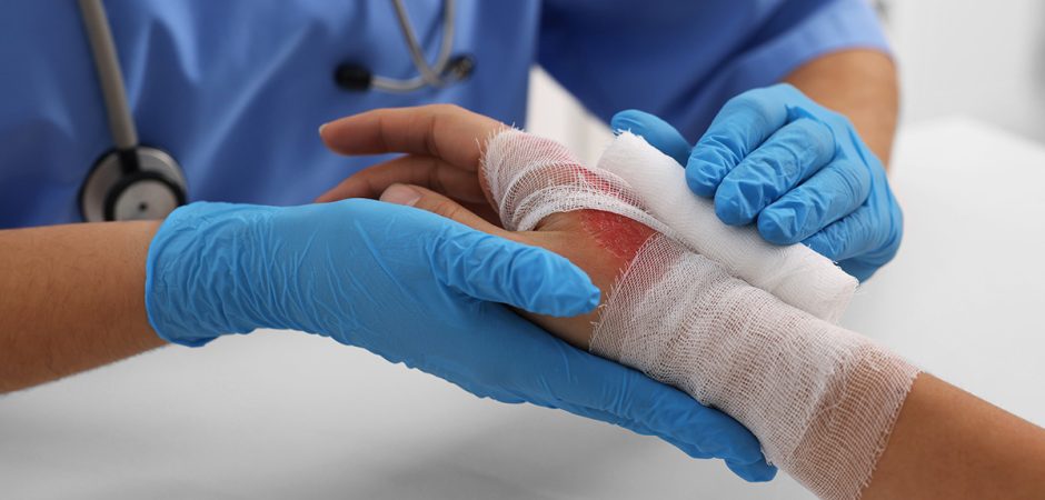 Baleseti égési sérülés esetén térítést nyújtó kiegészítő biztosítás